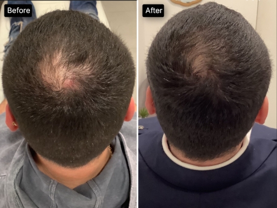 before after 2